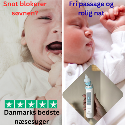 SnotFree Pro elektrisk næsesuger – Fri for stoppet næse på få sekunder